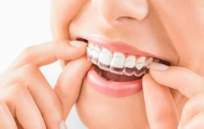 ارتودنسی نامرئی دندان