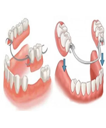 پروتز دندانی پارسیل