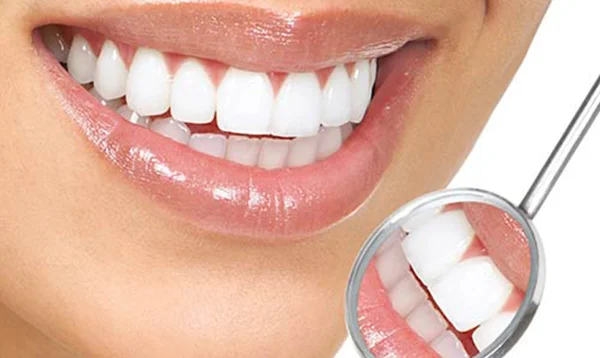 سفیدشدن دندان در اثر بلیچینگ یا جرم گیری دندان