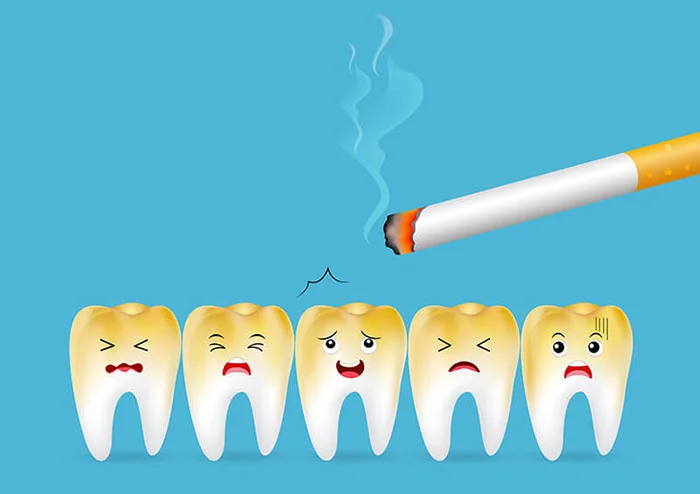 سلامت دندان تحت تاثیر سیگار