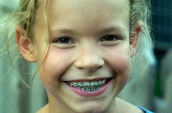 ارتودنسی دندان های کودکان