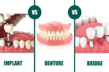 مقایسه پروتز متحرک و ثابت دندان